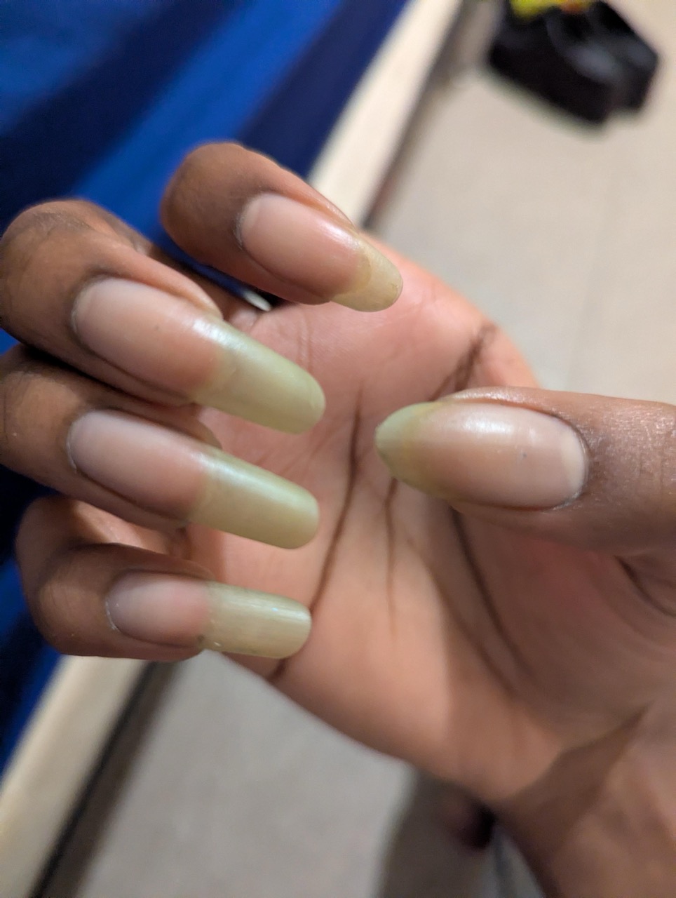 After taking off my nail polish (1) Large.jpeg